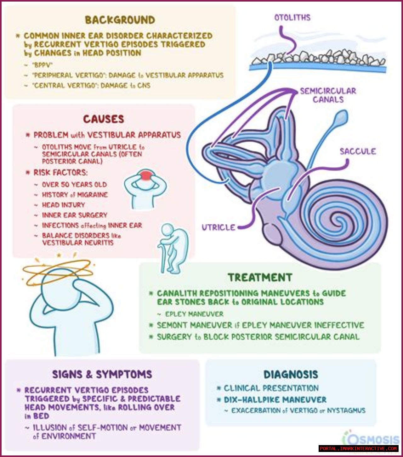 Does Flying Cause Vertigo? Uncovering The Link